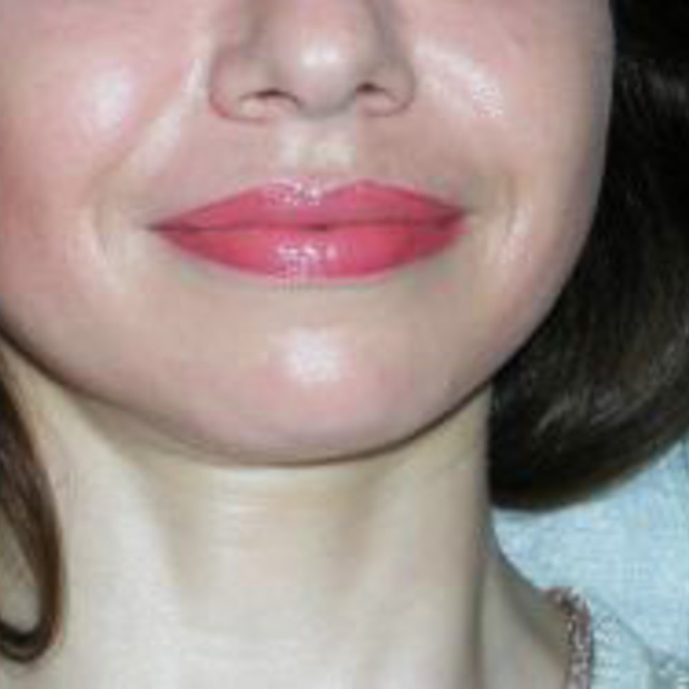 Galerie Bild 1